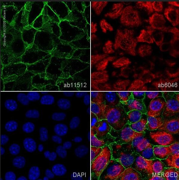 Anti-E Cadherin抗体[DECMA-1] - Intercellular Junction Marker
