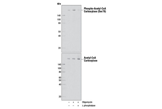 Phospho-Acetyl-CoA Carboxylase (Ser79) (D7D11) Rabbit mAb