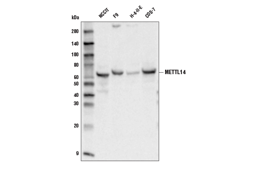 METTL14 (D8K8W) Rabbit mAb
