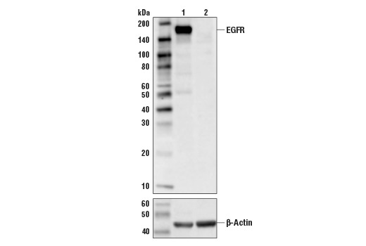 EGF Receptor (D38B1) XP Rabbit mAb