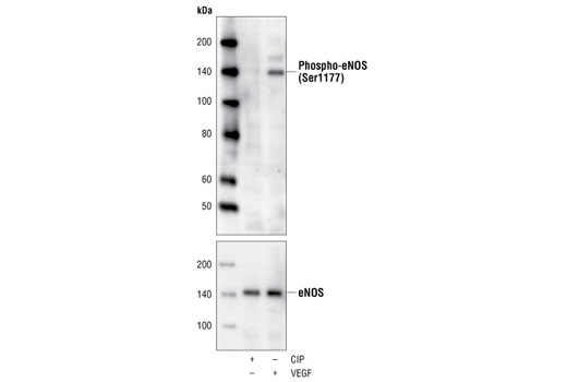 Phospho-eNOS (Ser1177) (C9C3) Rabbit mAb