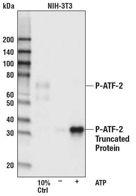 ATP (10 mM)