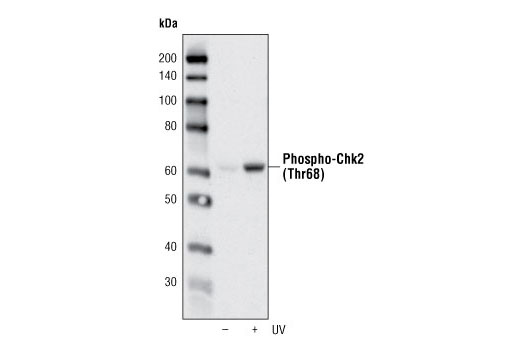 Cell Cycle/Checkpoint Antibody Sampler Kit