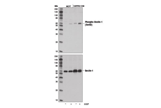 Phospho-Beclin-1 (Ser93) (D9A5G) Rabbit mAb
