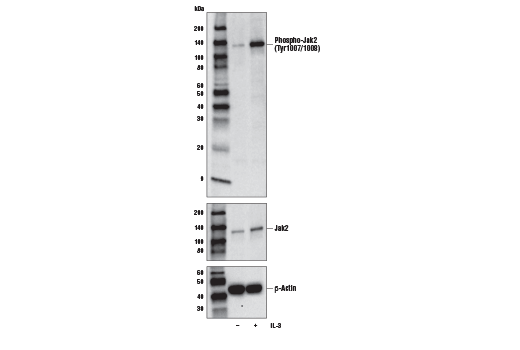 Phospho-Jak1 (Tyr1034/1035)/Jak2 (Tyr1007/1008) (E9Y7V) Mouse mAb
