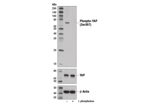 Phospho-YAP (Ser397) (D1E7Y) Rabbit mAb