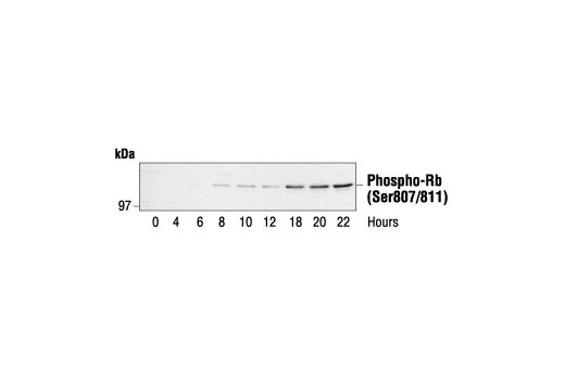 Phospho-Rb (Ser807/811) Antibody