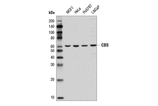 CBS (D8F2P) Rabbit mAb