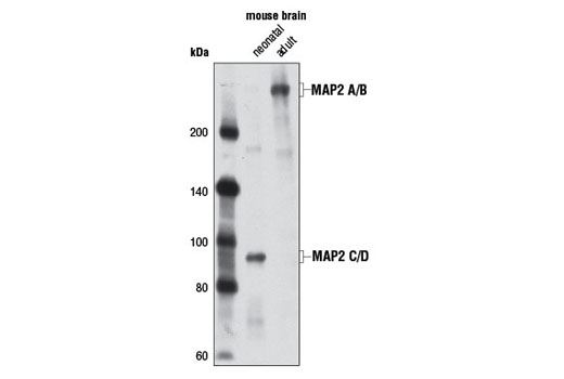 MAP2 (D5G1) XP Rabbit mAb