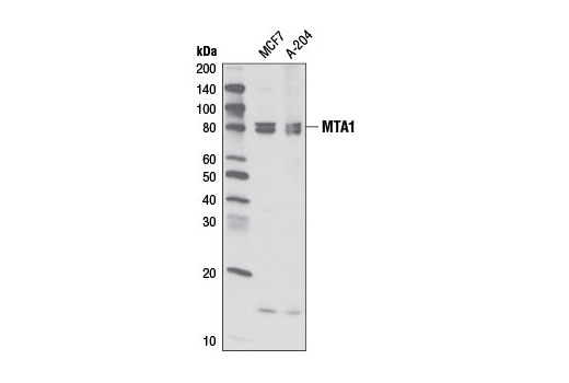 MTA1 (D17G10) Rabbit mAb