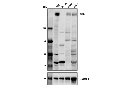 p300 (D1M7C) Rabbit mAb
