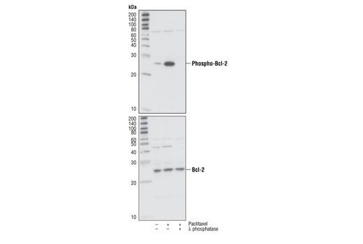 Phospho-Bcl-2 (Ser70) (5H2) Rabbit mAb