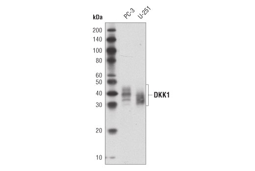 DKK1 (D5V6L) Rabbit mAb