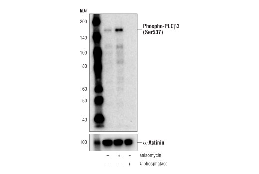 Phospho-PLCbeta3 (Ser537) (D8K2R) Rabbit mAb