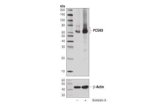 PCSK9 (D7U6L) Rabbit mAb
