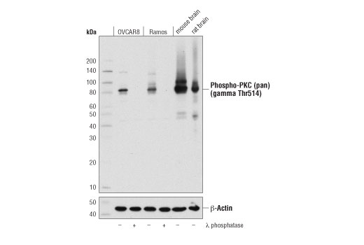 Phospho-PKC (pan) (gamma Thr514) (D6Y3D) Rabbit mAb