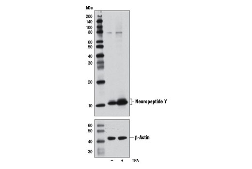 Neuropeptide Y (D7Y5A) XP Rabbit mAb