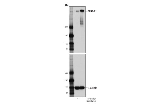 CENP-F (D6X4L) Rabbit mAb