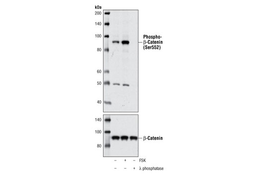 Phospho-β-Catenin (Ser552) Antibody