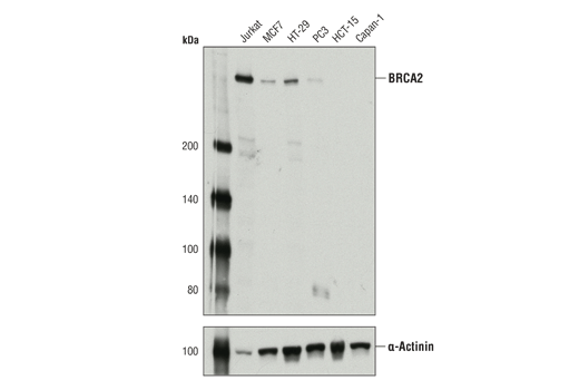 Fanconi Anemia Antibody Sampler Kit