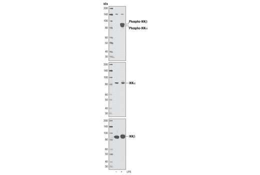 Phospho-IKKα/β (Ser176/180) Antibody Sampler Kit