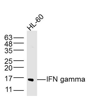 干扰素-γ/IFN-γ抗体