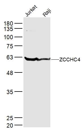 ZCCHC4蛋白抗体