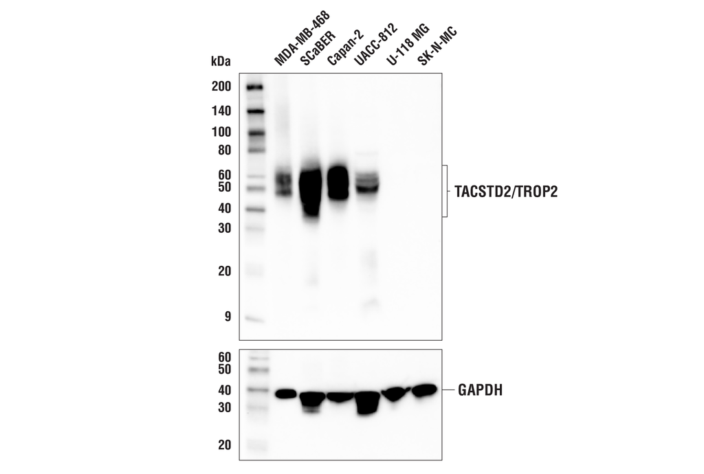TACSTD2/TROP2 (E8Y8S) Rabbit mAb