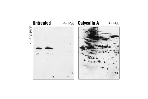 Phospho-Threonine/Tyrosine Antibody