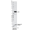 Phospho-4E-BP1 (Thr37/46) (236B4) Rabbit mAb