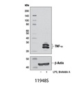 TNF-α (D2D4) XP Rabbit mAb (Mouse Specific)