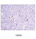 FoxP3 (D6O8R) Rabbit mAb