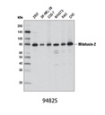 Mitofusin-2 (D2D10) Rabbit mAb