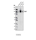 Tyro3 (D38C6) Rabbit mAb