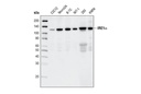 IRE1α (14C10) Rabbit mAb
