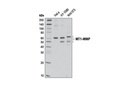 Matrix Remodeling Antibody Sampler Kit