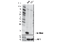 p16 INK4A (D7C1M) Rabbit mAb