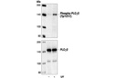 Phospho-PLCγ2 (Tyr1217) Antibody