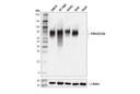 PVR/CD155 (D8A5G) Rabbit mAb