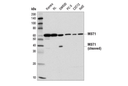 MST1 (D8B9Q) Rabbit mAb