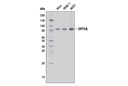 CPT1A (D3B3) Rabbit mAb