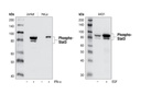 Phospho-Stat3 (Tyr705) (D3A7) XP Rabbit mAb