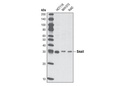 Snail (L70G2) Mouse mAb