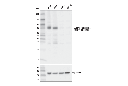 Androgen Receptor (AR-V7 Specific) (E3O8L) Rabbit mAb
