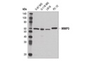 MMP-3 (D7F5B) Rabbit mAb