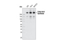 Fatty Acid Synthase (C20G5) Rabbit mAb