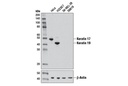 Keratin 17/19 (D4G2) XP Rabbit mAb