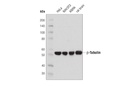 β-Tubulin (D3U1W) Mouse mAb