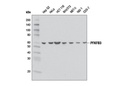 PFKFB3 (D7H4Q) Rabbit mAb