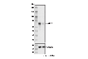 ATF-2 (D4L2X) XP Rabbit mAb